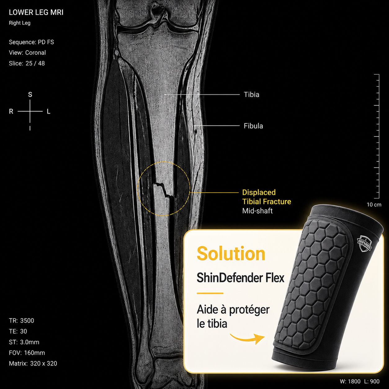 ShinDefender Flex : Le protège-tibia léger, confortable et conçu pour rester bien en place.